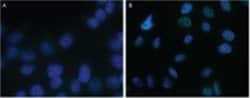 Complement receptor C5aR (CD88) Mouse anti-Human, Clone: S5/1, MilliporeSigma:Antibodies:Primary